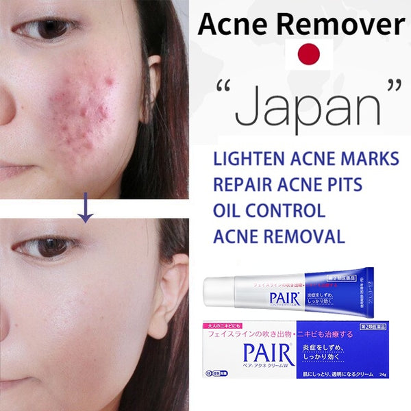 Lion | Pair Acne Cream W